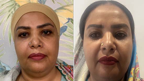 Luminance Clinic | Best Dermatologist Clinic