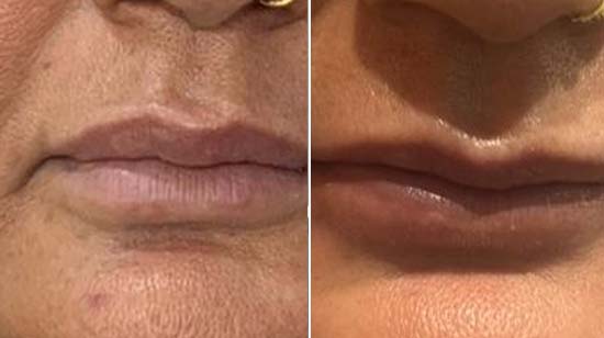 Luminance Clinic | Best Laser Treatment Clinic
