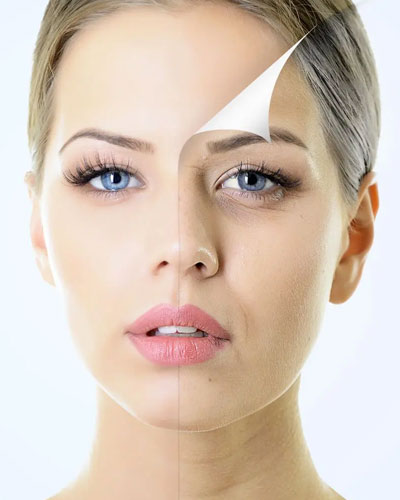 Chemical Peeling Service