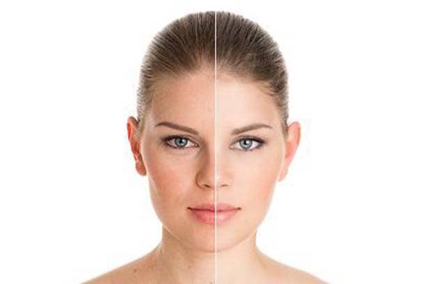 Vitiligo Treatment clinic in GK1